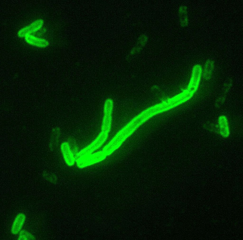 Yersinia pestis bakterisi [Wikipedia]