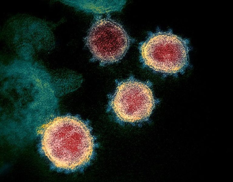 NIAID coronavirus