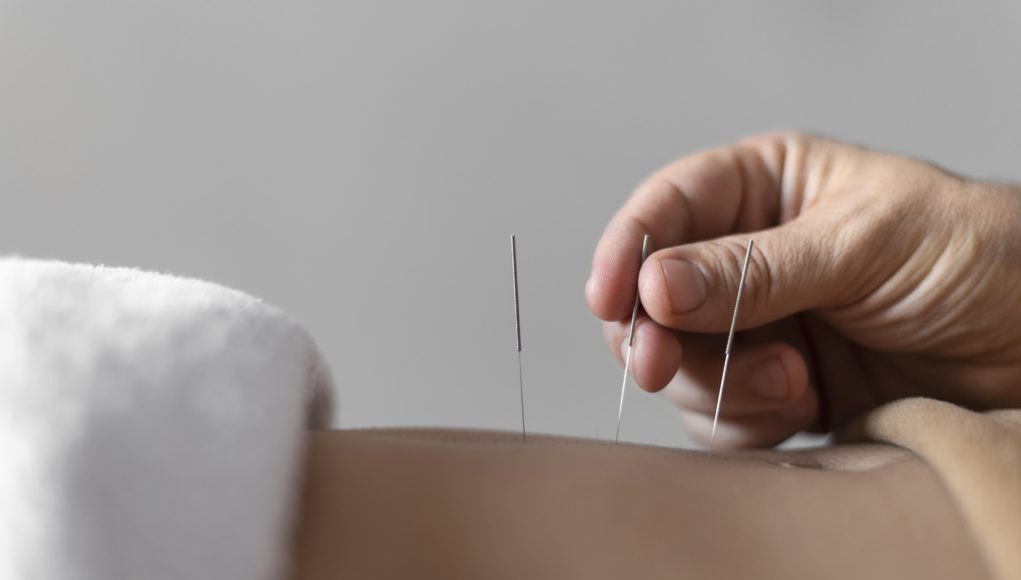 close up hand holding acupuncture needle scaled